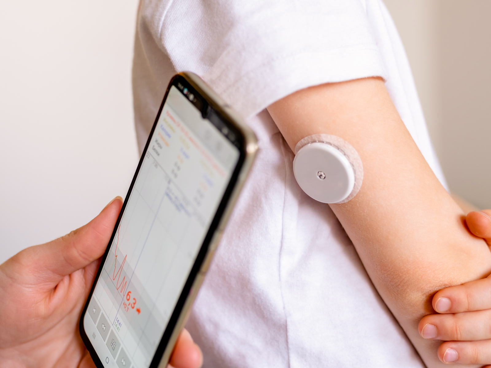 How to Leverage Remote Glucose Monitoring in Diabetic Care